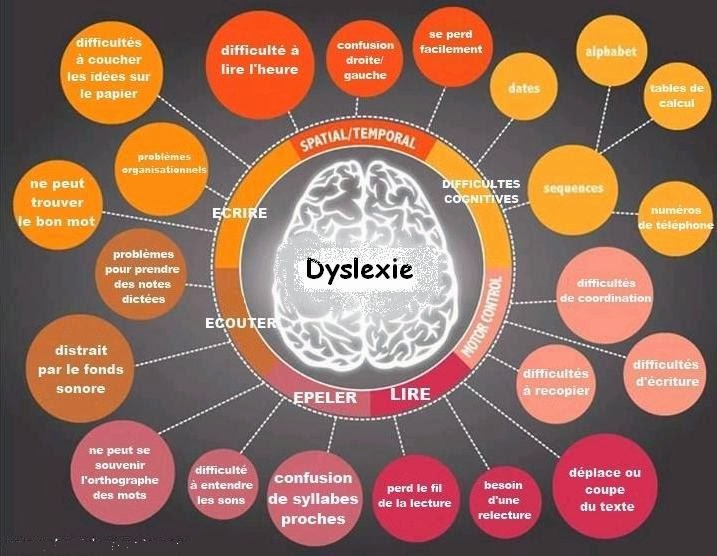 Dyslexie_Schéma